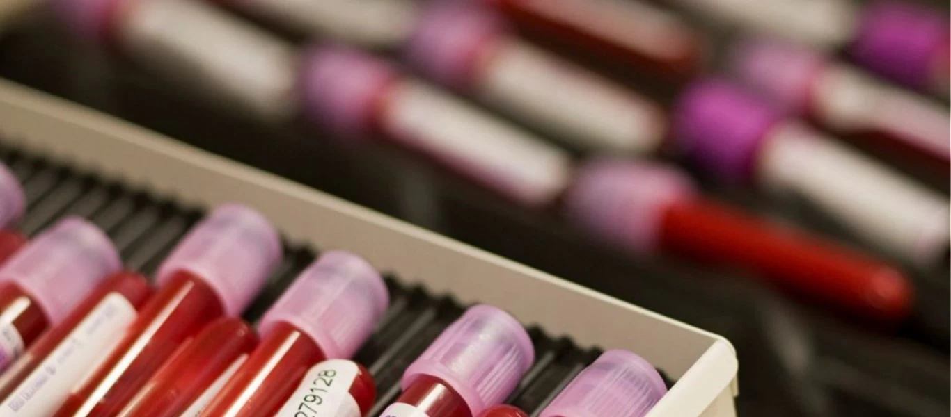 Η σπάνια ομάδα αίματος που έχουν λιγότερα από 50 άτομα παγκοσμίως